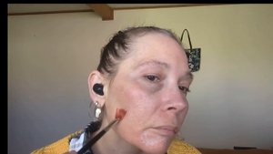 Using Simildiet Yellow Peel