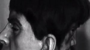 НЕВЕРОЯТНО ЖУТКО! У ЭТОГО ЧЕЛОВЕКА ДВА ЛИЦА! ИСТОРИЯ ЭДВАРДА МОРДРЕЙКА