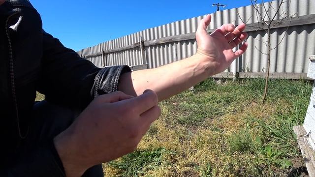 Пчелиный яд - мощный антисептик от природы. Пчелоужаления, как привильно извлечь жало пчелы.