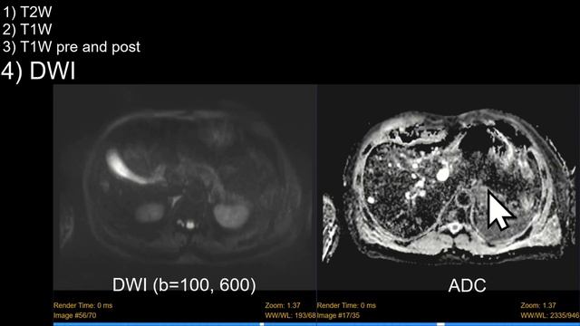 Introduction to Liver MRI: Approach and Case-Based Course смотреть онлайн