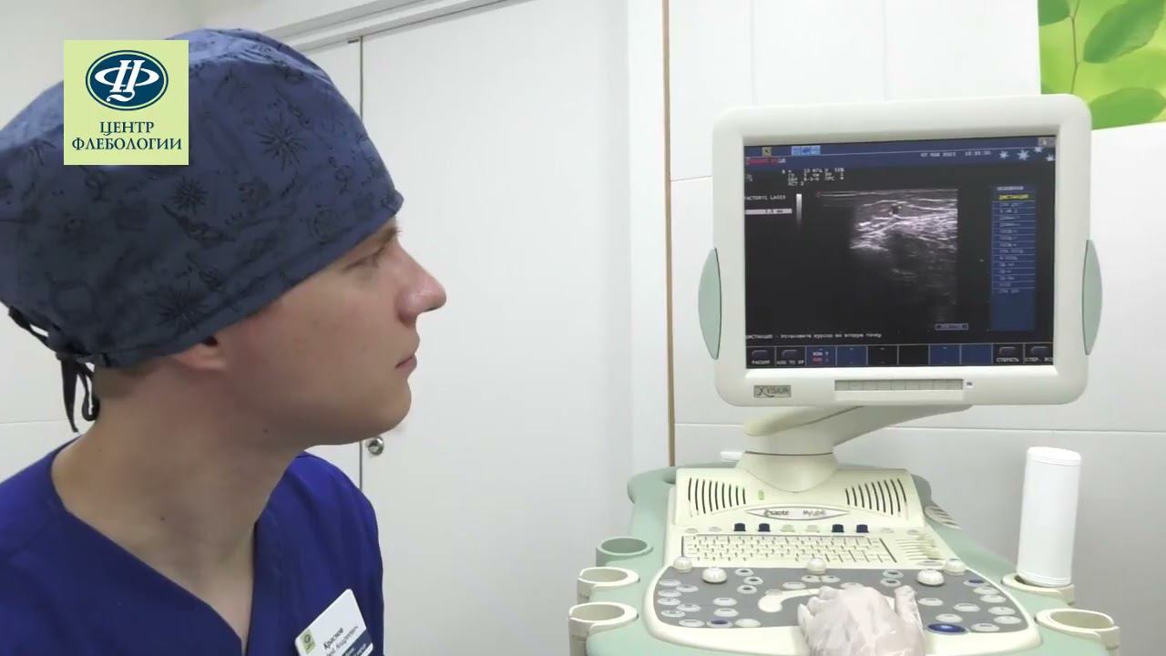 Зачем при лечении сосудистых звездочек на ногах делать УЗИ вен?