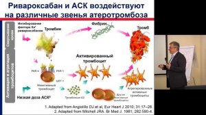 Новые возможности профилактики сосудистых событий с использованием ривароксабана