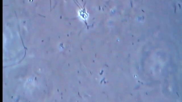 Инфузория Сувойка (Vorticella) смотреть онлайн