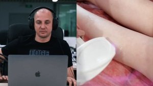 ??? Все о лазерной эпиляции на диодном лазере. Обучение лазерной эпиляции. Теория и практика