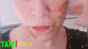 SADECE İKİ MALZEME İLE KIRIŞIKLIK GİDERİCİ MASKE!!!