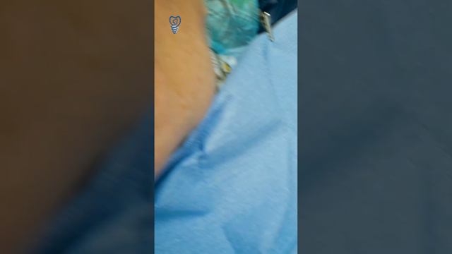 Удаление 11 зубов, 6 имплантатов и плюс временные конструкции. Пациентке 85 лет. Имплантация зубов.