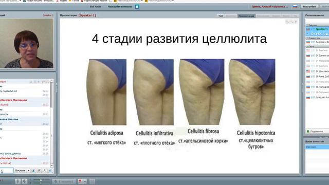 Причины возникновения целлюлита и методы борьбы с ним! Спикер Ольга Бондаренко