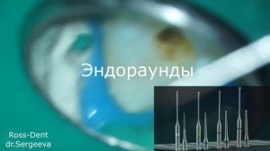 Видеоурок Механическая обработка корневых каналов, пошаговый протокол