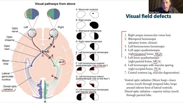 Неврология для USMLE Step 1 - Черепные нервы (часть 1) смотреть онлайн