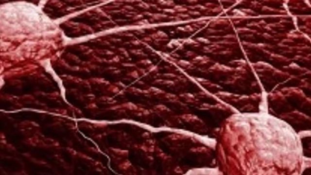 УЧЕНЫЕ НАЗВАЛИ Начальные признаки рака / Названы признаки рака