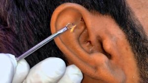 Blackheads in ear @poppingblackheads