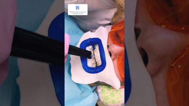 Свежее дыхание облегчает понимание смотреть онлайн