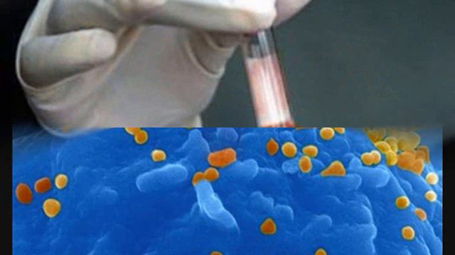 Вылечили ребенка от ВИЧ-инфекции