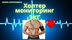 Холтер мониторинг суточный. Холтер ЭКГ. Что это и зачем? Жизнь клапанщика.