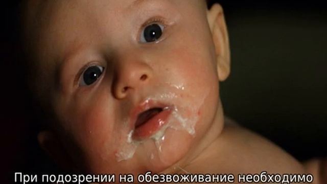 Признаки обезвоживания у ребенка