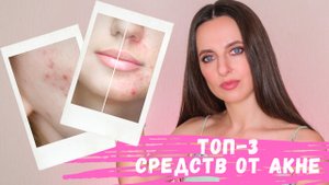 КАК избавиться от ПРЫЩЕЙ | Три СУПЕР средства от АКНЕ