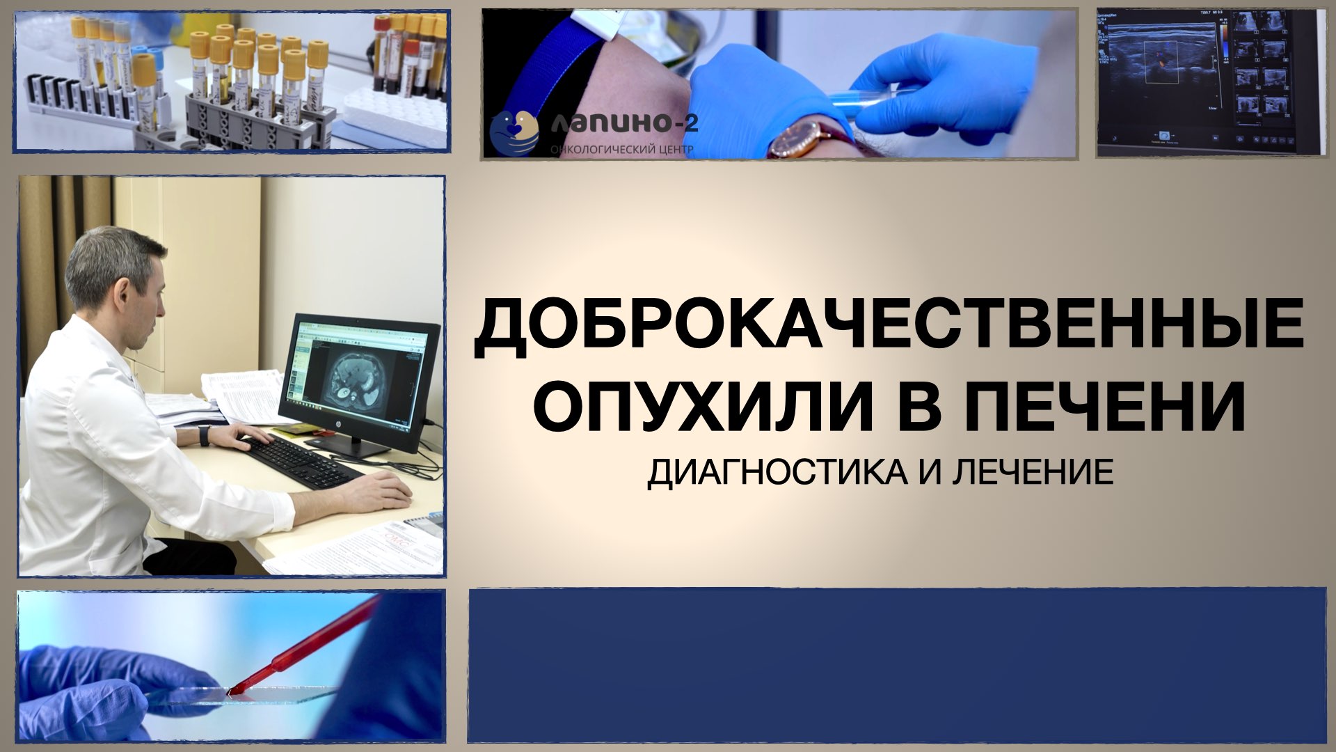 Доброкачественные опухоли печени: диагностика и лечение.