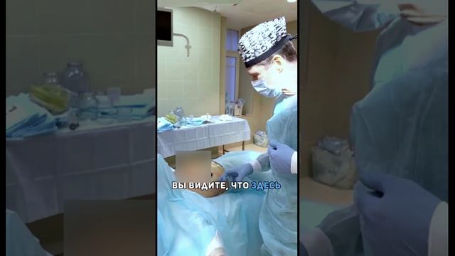 Что значит "грудь без шва"?  #пластическаяхирургия