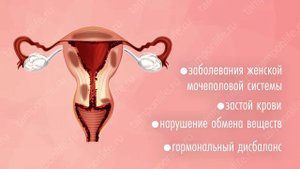 Как действуют китайские тампоны Beautiful Life?