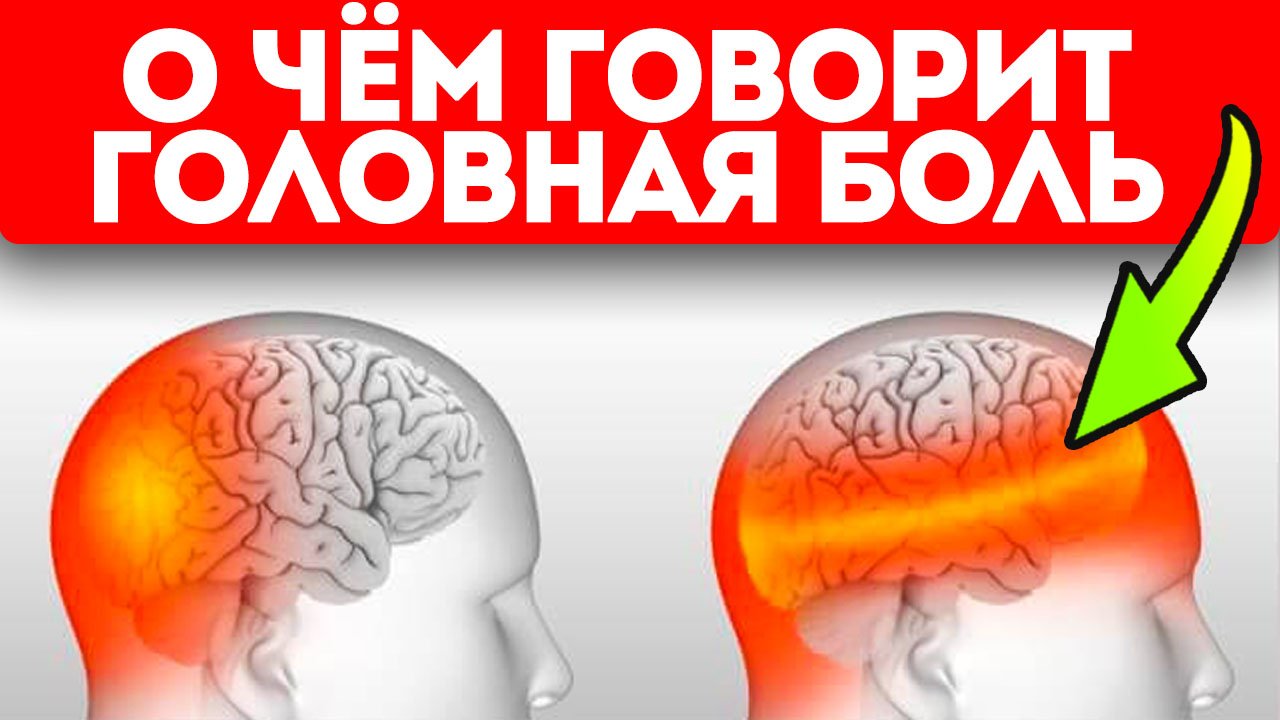 Смотрите, о чём предупреждает тело, когда голова болит так! 6 типов головной боли и что делать