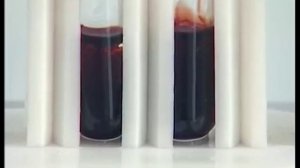 Химическая кинетика и химическое равновесие. Опыт 2