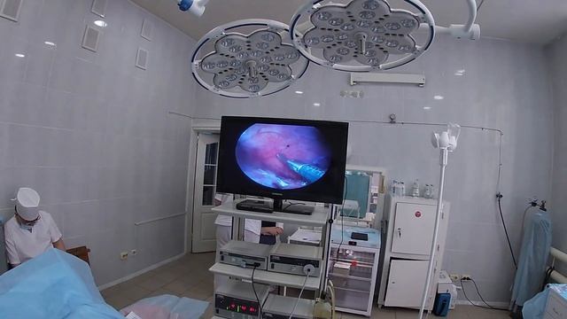 Однопортовая аппендэктомия. Аппендэктомия через один прокол.SILS Appendectomy.Кокшетау.Аппендицит.