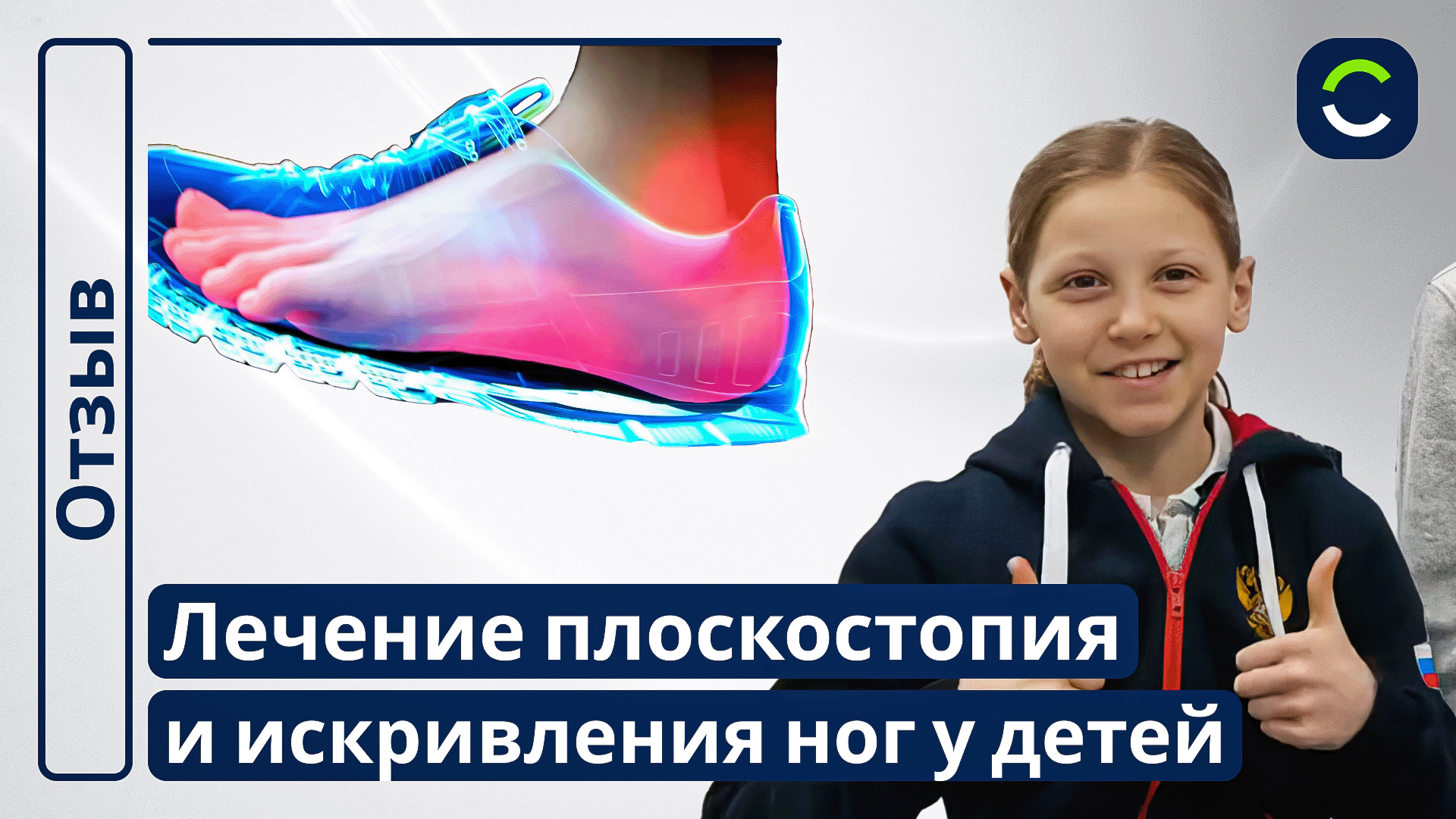 Лечение Искревления Ног и Плоскостопия | Отзывы Наших Пациентов