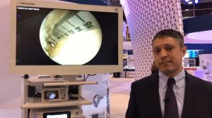Digital Surgery Solutions: DePuy Synthes PUREVUE Visualization System for Imaging in MIS