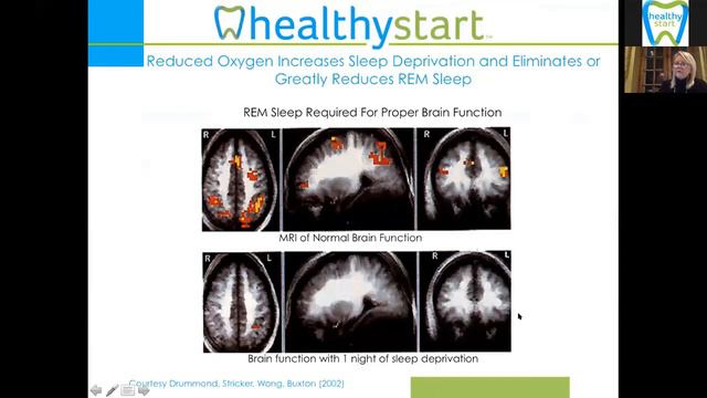 HealthyStart® Medical Webinar featuring Leslie Stevens December 13 смотреть онлайн