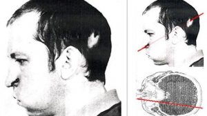 Что будет, если человек попадет в ускоритель частиц? Советский коллайдер.