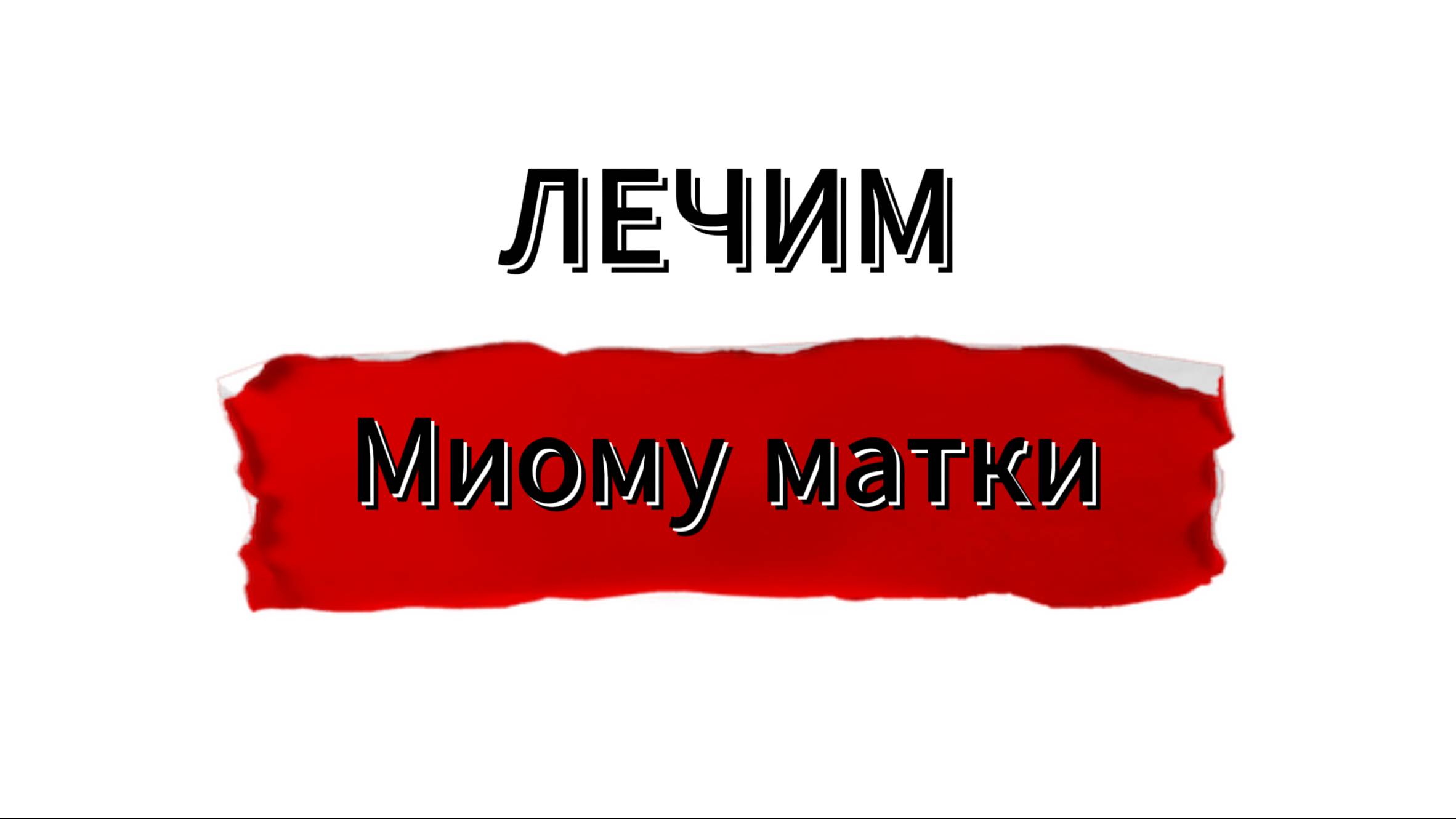 Лечение миомы матки