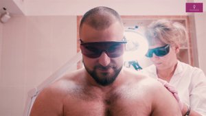 Лазерная эпиляция для мужчин