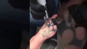 Лазерное удаление татуировки Сtrl+z