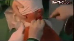 Удаление гланд . Для всех желающих вернуться в СССР.