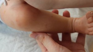 Заболел малыш / лечим новорождённого от ветрянки / игра с куклой реборн