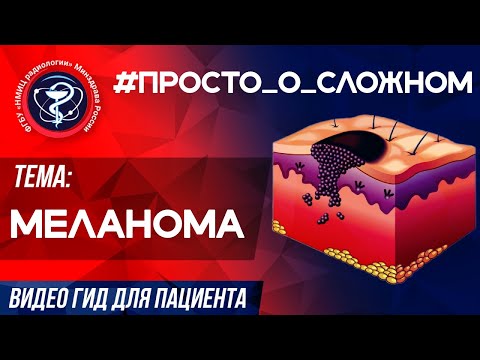 #ПРОСТО_о_СЛОЖНОМ  - МЕЛАНОМА.