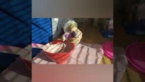Процесс изготовления слепков зубов