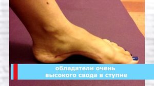 Несколько причин почему долго не стоит носить кроксы!