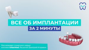 Всё об имплантации за 2 минуты!