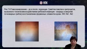 Буканова А.В. «ВОЗДЕЙСТВИЕ КФС  НА ЭРИТРОЦИТЫ, ИММУННЫЕ КЛЕТКИ И СВЕРТЫВАЮЩУЮ СИСТЕМУ КРОВИ» 4.06.2