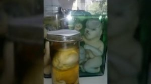 Последствие ядерного испытания в Семипалатинске !