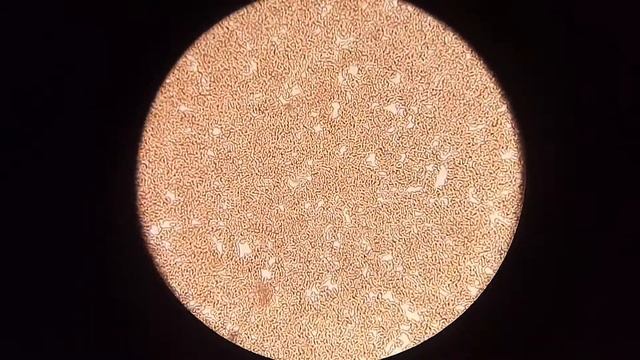 Кровь после болгарского перца. Что будет? смотреть онлайн