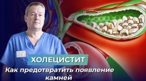 КАЛЬКУЛЁЗНЫЙ ХОЛЕЦИСТИТ от чего возникает? ПРОФИЛАКТИКА воспаления желчного пузыря.
