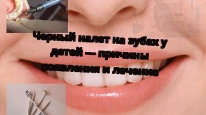 Черный налет на зубах у детей — причины появления и лечение
