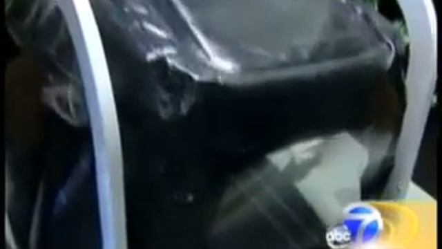 AlterG Therapy Revolutionizing Rehabilitation and Retraining