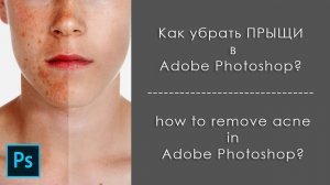 Как быстро убрать прыщи  в Фотошопе!