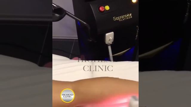 Highend Clinic - Soprano Ice Buz Lazer Epilasyon