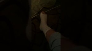 Боковой перелом латеральной лодыжки моя история