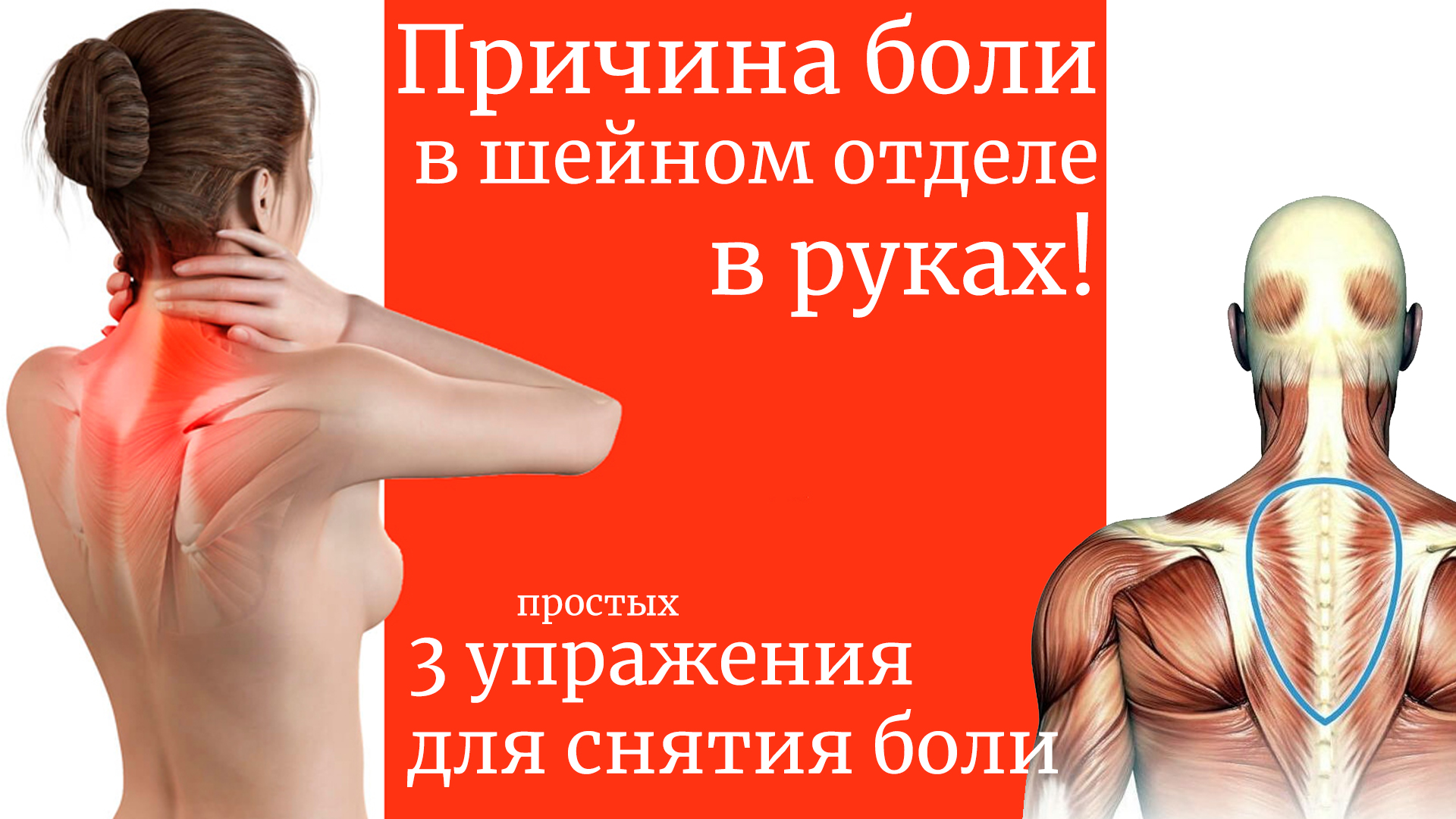 Причина боли в шейном отделе в руках! 3 упражнения для снятия боли