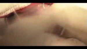 лечение тиреотоксикоза